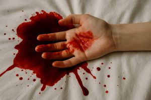 Was bedeutet es, wenn man von Blut träumt: vollständige Deutung