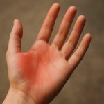 Linke Handfläche juckt – was bedeutet das und was sagt die Wissenschaft dazu